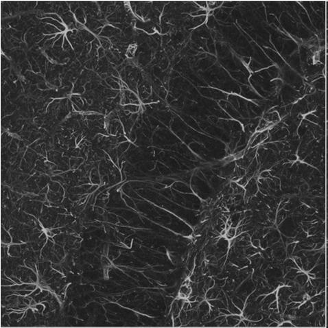 * makroglej Komórki glejowe astrocyty (komórki gwiaździste) największe komórkami glejowe (8 15 µm) otaczają neurony mają liczne wypustki (m.in.