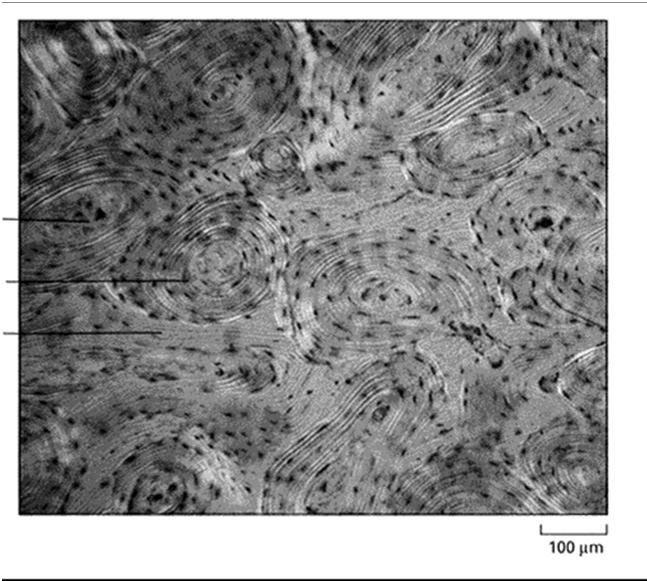 Tkanka kostna osteocyty (w jamkach) (wymiana substancji odŝywczych i metabolitów w kości) osteoblasty (komórki kościotwórcze) osteoklasty (komórki kościogubne) bogata ECM - zmineralizowana kolageny