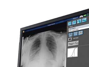 Oprogramowanie DIRECTVIEW V5 CR i DR JEDNO OPROGRAMOWANIE DLA WIĘKSZEJ WYDAJNOŚCI.