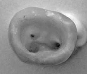 Reconstructed 3D representation structure of A2 teeth after endodontic preparation Ryc. 8.