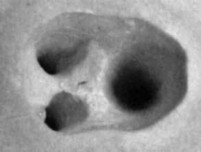 74 M. Tanasiewicz Fig. 11. Negative polymer representations of inner space of tooth A2 after endodontic preparation Ryc. 11. Polimerowe odwzorowanie przestrzeni wewnętrznych zęba A2 po opracowaniu endodontycznym Fig.