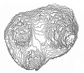 Reconstructed 3D representation of negative polymer representations of inner space of tooth A2 Ryc. 12. Przestrzenna rekonstrukcja odwzorowania polimerowego Fig. 13.