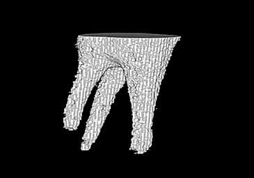 Model gipsowy przestrzeni wewnętrznych zęba A2 uzyskany na podstawie odwzorowania polimerowego The next research proceedings made it possible to compare the images of internal tooth space af- ter