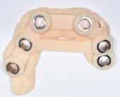 Implantacja w koncepcji Pro Arch Straumann Pro Arch Rehabilitacja pacjentów bezzębnych przy późnej implantacji oraz przy natychmiastowej implantacji z