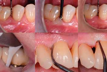 Kliniczna i radiologiczna diagnostyka periodontologiczna. 3. Etiologia i patogeneza chorób przyzębia i tkanek wokół implantów 4.