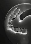 Straumann ProArch is focused on treatment of fully edentulous patients using fixed restorations and immediate loading protocols.