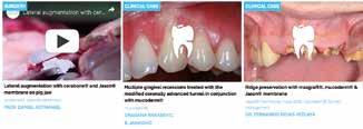 In this two-day course you learn and practice different bone augmentation concepts