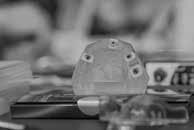 On the other side thin biotype needs new surgical approaches with specific instruments.