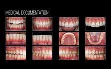 omówienie przeprowadzonych zabiegów i kluczowych elementów powodzenia leczenia DR KRZYSZTOF CHMIELEWSKI, DDS, MSC podstawy fotografii praktyczne wykonywanie portfolio na potrzeby dokumentacji