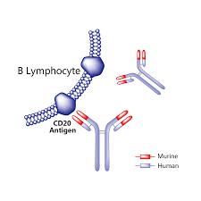 Leczenie Chemioterapia Radioterapia Przeszczepienia Szpiku kostnego w niektórych przypadkach Immunoterapia Przy uzyciu przeciwciał