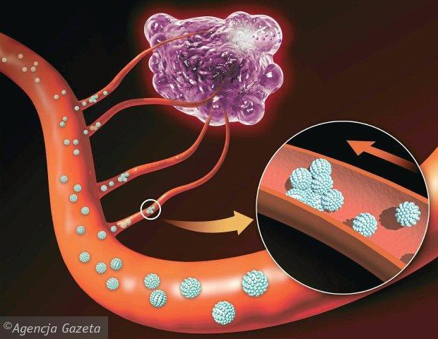 Chemioterapia Działa cytotoksycznie Niespecyficznie na komórki