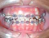 Center Since 1984, we have taught thousands of dentists real life knowledge to perform orthodontics successfully on every case.