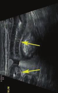 , Aunt Minnie`s Atls nd Imging-Specific Dignosis, Wyd. Lippincott Willims & Wilkins, 2009. 6. Iry D.