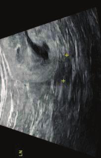 , Medicl students preferences in rdiology eduction comprison etween the Socrtic nd didctic methods