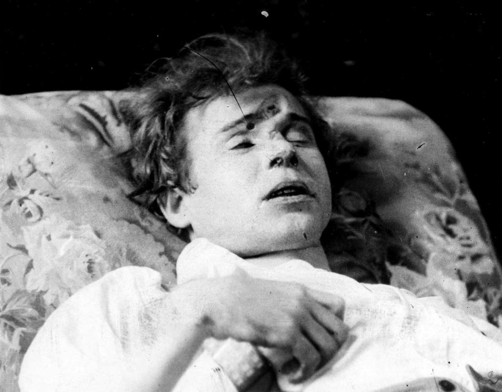 Śmierć Sergiusza Jesienina samobójstwo czy zabójstwo 23 Fot. 1. Pośmiertne zdjęcie Sergiusza Jesienina przedstawiające zniekształcenie czaszki w okolicy czołowej Źródło: www.esenin.