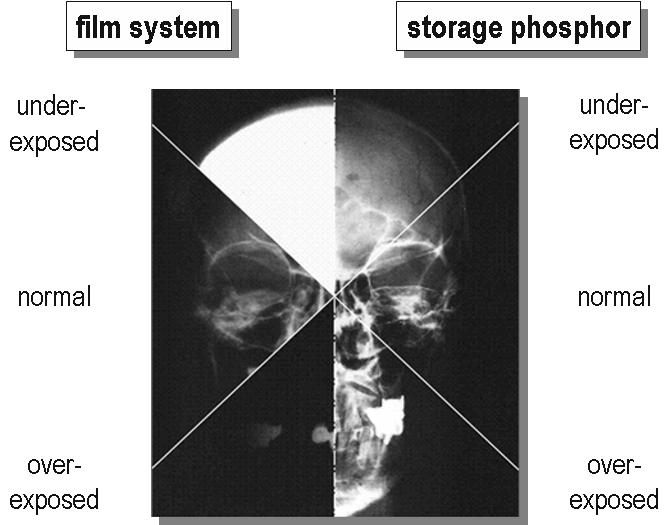 Zastosowania obrazowanie diagnostyka rentgenowska: płytki PSP (Photostimulable Phosphor) Storage Materiały: BaFBr:Eu 2+, RbBr:Ga +, CsBr:Ga +, CsBr:Eu M. Sonoda et al.