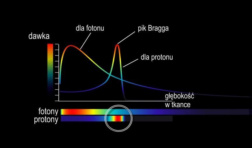16 FOTON 123, Zima 2013 Terapia hadronowa w Krakowie Małgorzata Nowina-Konopka Instytut Fizyki Jądrowej PAN, Kraków Pod koniec XIX wieku, wkrótce po odkryciu Roentgena, do leczenia nowotworów używano