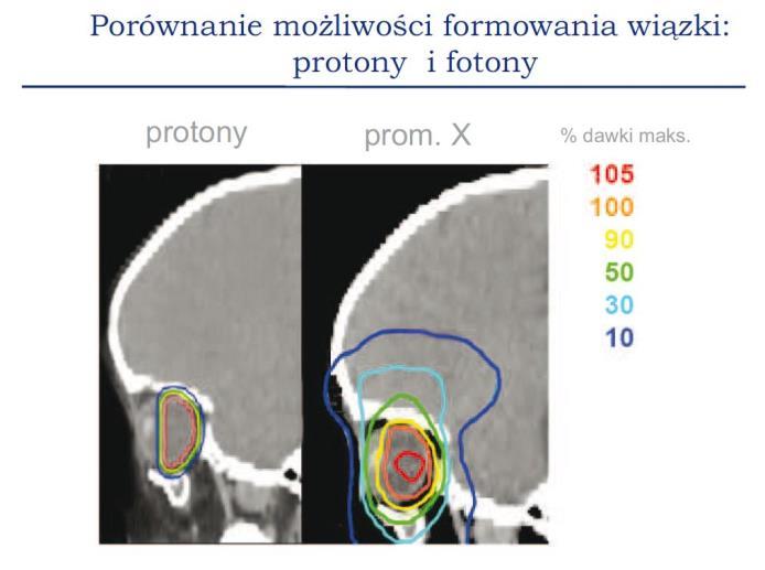 FOTON 123, Zima 2013 17 rze. Można tak dopasować parametry wiązki protonów, żeby zniszczyć wyłącznie komórki nowotworowe, zachowując całkowicie zdrową tkankę wokół guza.
