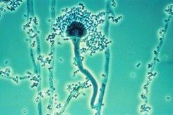 7Kropidlak popielaty (Aspergillusfumigatus) Dodatkowo ich działanie zależy także od gatunku docelowego, czyli tego który narażony jest na ich działanie.
