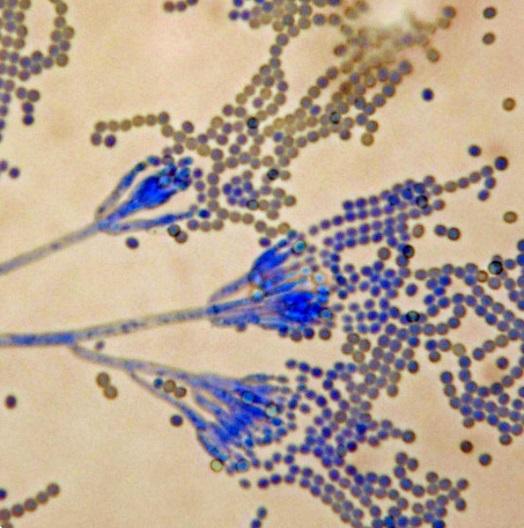 Aflatoksyny wiążą się bezpośrednio z DNA, powodując działanie mutagenne oraz rakotwórcze. Dodatkowo aflatoksyny atakują także wątrobę.