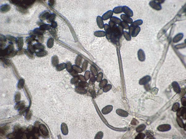 Trichotheceny Rys. 4.9Wzór strukturalny ochratoksyny A Trichotheceny są wytwarzane głównie przez grzyby z rodzaju Fusarium (na przykład F. sporotrichioides, F. graminearum, F. poae and F.