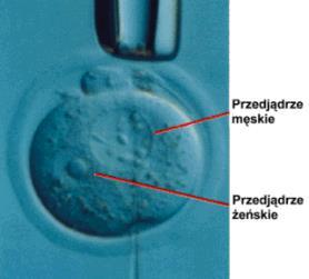 2) Mikroiniekcja in vitro
