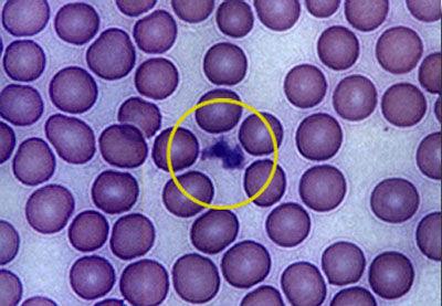 Trombocyty Płytki krwi są bezjądrowymi fragmentami cytoplazmy dużych komórek, zwanych megakaiocytami.
