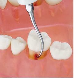 PERIODONTOLOGIA Do usuwania biofilmu