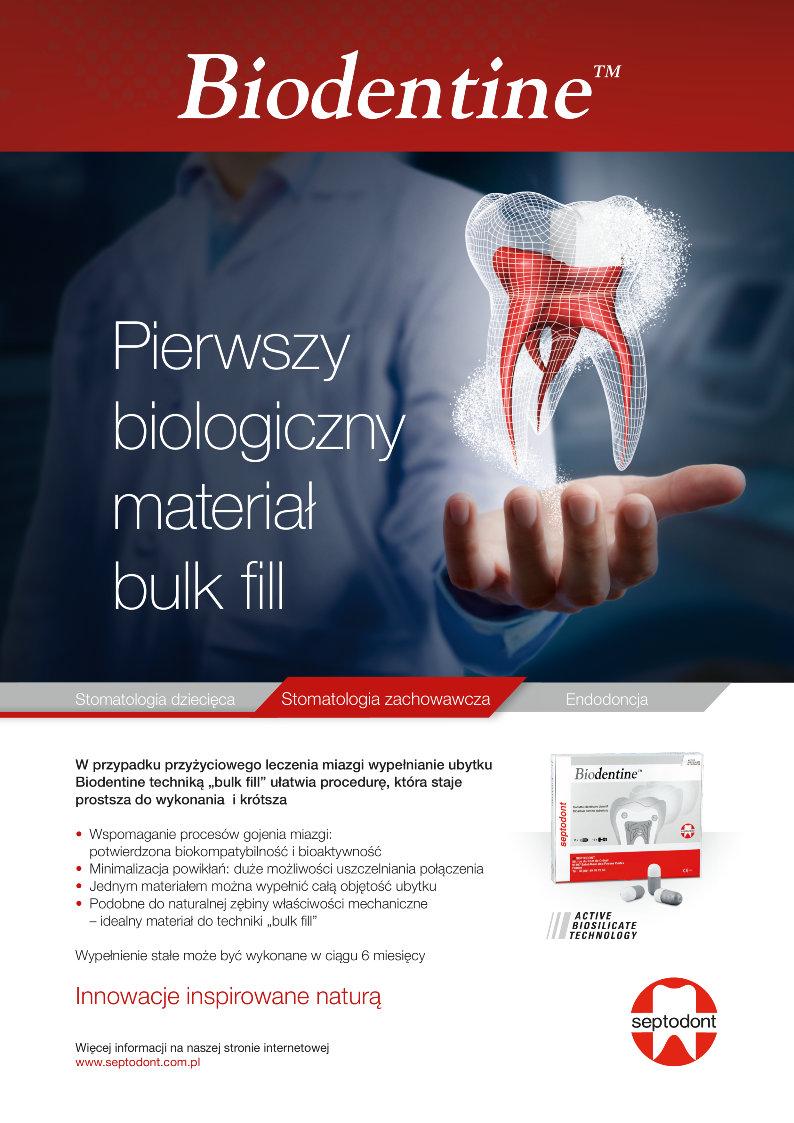 DENTAL TRIBUNE Polish Edition Praktyka 3 właściwości, tj. szybkości wiązania, tak istotnej przy tego typu uszkodzeniach i możliwości manipulowania samym materiałem.