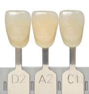w poniedziałek A2E i A2D do odbudowy zęba w kolorze C1, a w środę do zęba w kolorze D2, a w czwartek do zęba w kolorze A2. Czy to nieprawdopodobne?