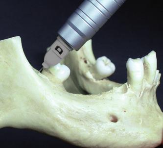 palpacyjnie. Więcej informacji i filmów znajdziesz na stronie www.mydentalhitec.