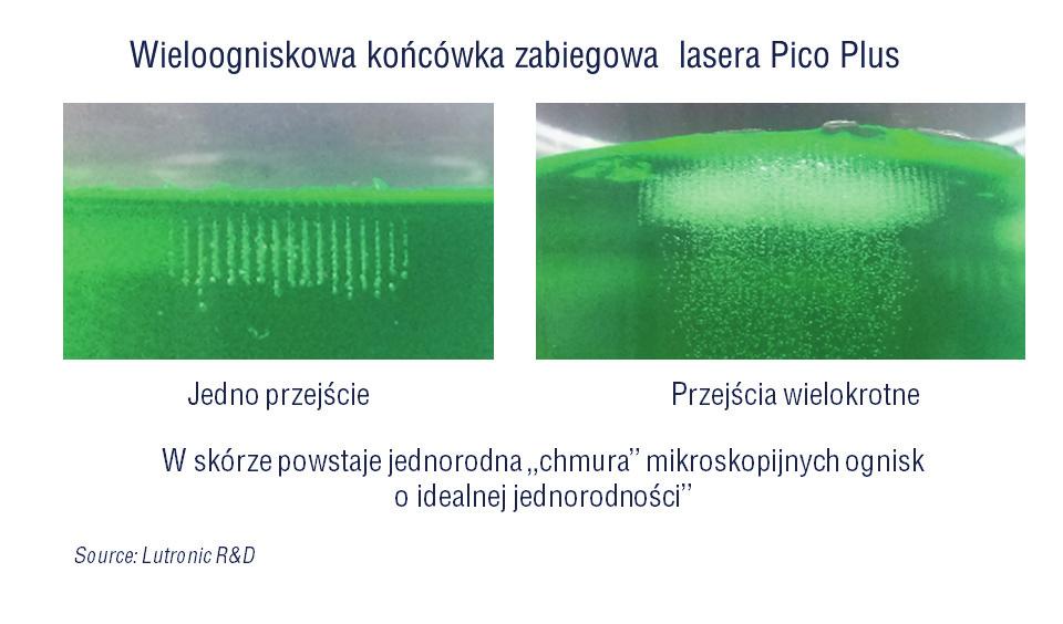 Ryc. 1. Efekt działania impulsu pikosekundowego z końcówki wieloogniskowej na fantom skóry. Pole działania 7.4 x 7.4 mm @ 1064 nm, 450 ps, 81 mikro ognisk (9x9) o średnicy 100 m każde.