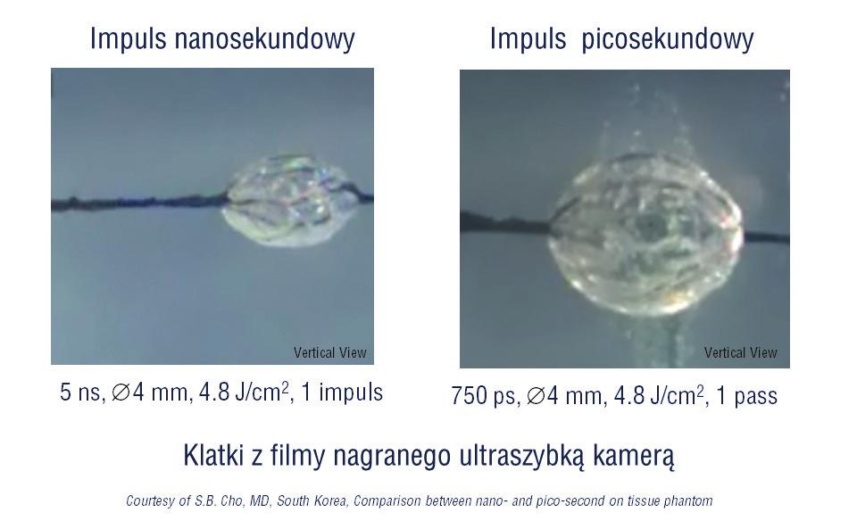 W pra cy [4] prze pro wa dzo no nie zwy kle cie ka we ba da nie efek tyw no ści pul we ry za cji roz drob nie nia barw ni ka (czar ny atra ment) za to pio ne go w fan to mie skóry (hy dro że lu po