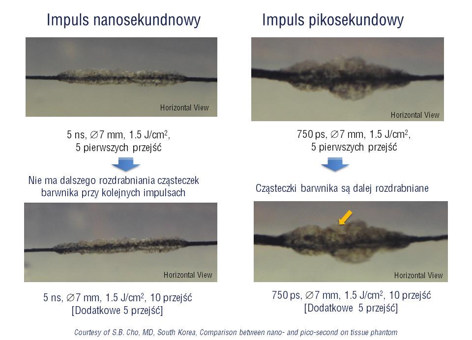Ryc. 5. Porównanie skuteczności pulweryzacji barwnika kolejnymi naświetleniami lasera nano- i pikosekundowego [].