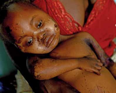 W Malawi możemy podziwiać niesamowitą przyrodę i jej bogactwo: słonie, hipopotamy, zebry, krokodyle i wiele gatunków ptaków, które występują na przykład w Parku Narodowym Liwonde, znajdującym się w