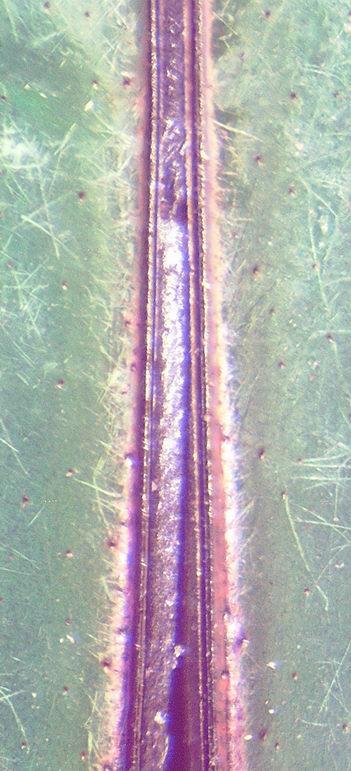 torquata immaculicollis (F., 1775) Na (Rys.
