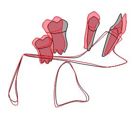 the Pt point created at the distal outline of pterygo maxillary fissure and perpendicular to the FH plane (Frankfort horizontal