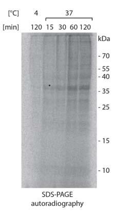 MMP-9 protein is enriched in the synaptoneurosomal fraction Hippocampus or cortex HOMOGENIZATION