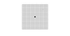 4 S t r o n a Astigmatism Snellen Fixation