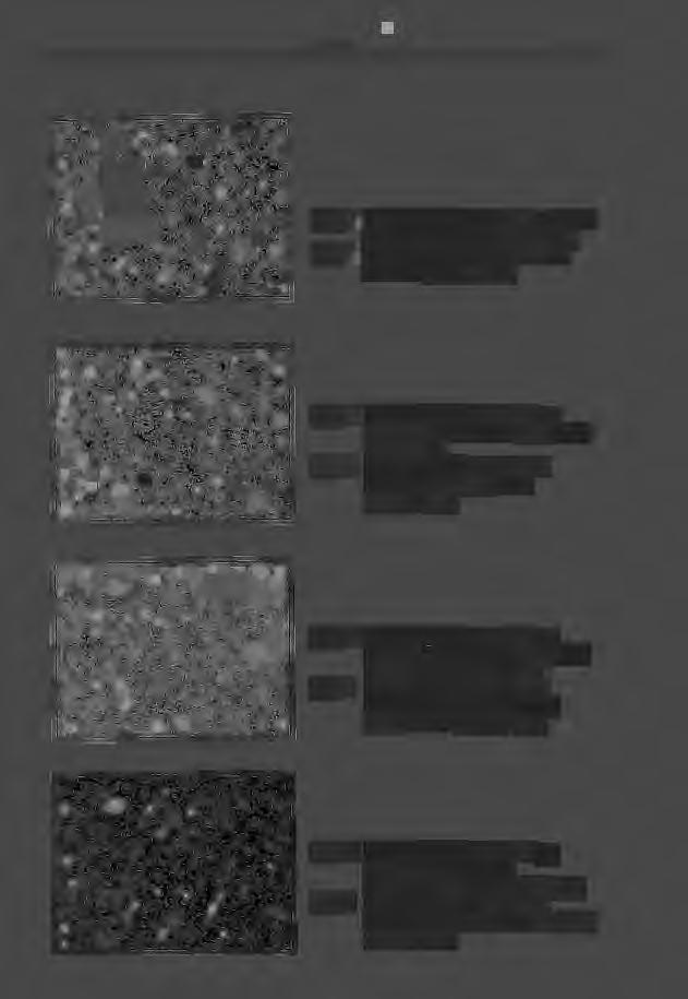 - 204 - Rys. 1. Mikrostruktura stopu AK7 w stanie niemodyfikowanym (pow. 1 OOx) Fig. 1. Microstructure of alloy AK? no modified (magn. 1 OOx) Rys. 2. Mikrostruktura stopu AK? po modyfikacji dodatkiem 0,5% Al84 (pow.