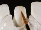 INSTRUKCJA WARSTWOWANIA PORCELANY ZIRLUX LC PREPARACJA PRZED APLIKACJĄ PORCELANY Jeśli podbudowa cyrkonowa była