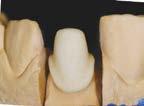 Zmieszaj stainy z ADDS (American Diversified Dental System) pomaluj i wypal.