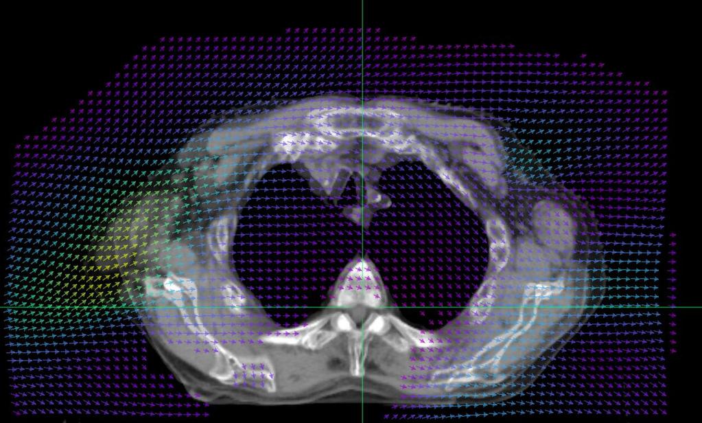 Dose Deformation