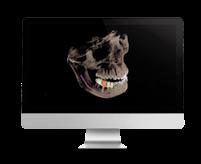 DENTSPLY SIRONA SICAT FUNCTION Oprogramowanie pozwalające na diagnozę oraz zaplanowanie leczenia