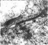 pałeczkowate jadro organelle zgrupowane na