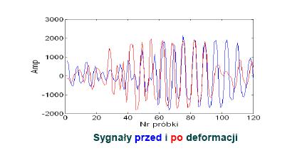 lokalnych przesunięć ech (odpowiadających przemieszczeniom tkanki) oraz wyznaczenia pochodnej tych przesunięć.
