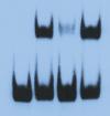 EMSA- Gel Shift Assay Opóźnione DNA (związane z białkiem) Wolne DNA UWAGA: w eksperymentach typu EMSA