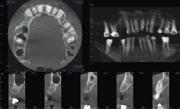 Zredukowana wysokość skanu do 6 x Ø8 cm zapewnia pełną wartość diagnostyczną w