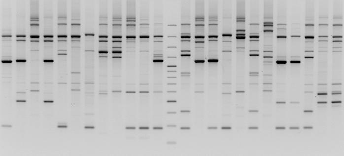Fot. 1 Przykładowe elektroforogramy dla izolatów Claviceps purpurea z produktami PCR amplifikowanymi za pomocą starterów (A) RAPD-OPA-08 i (B) SRAP_TC-GA (A) (B) Tabela 7.