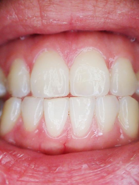 gums clenched teeth H o m e y e n g